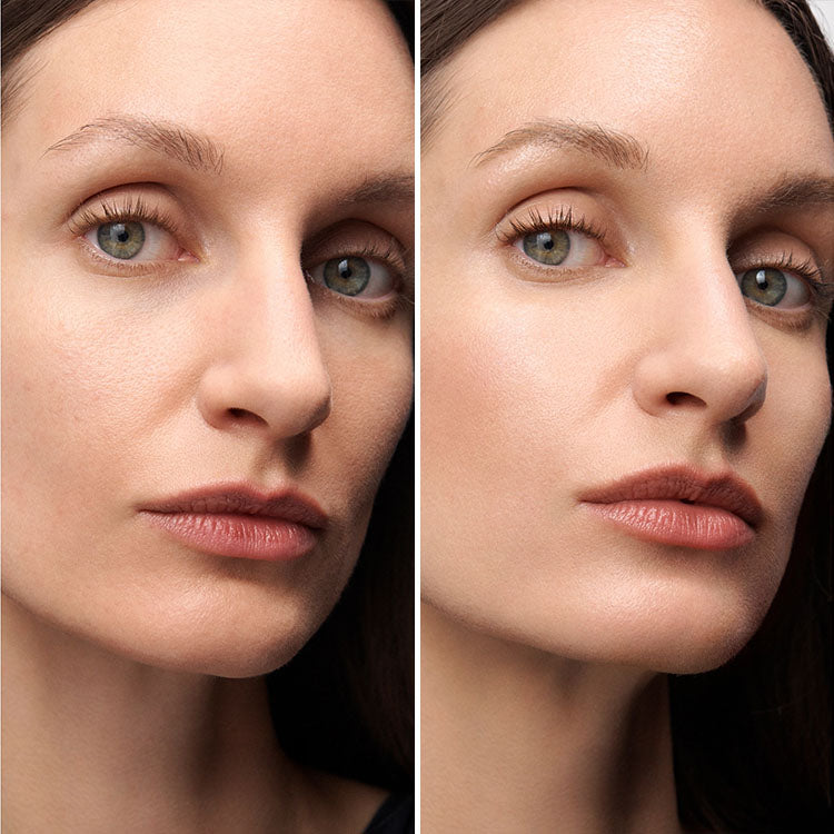 LED Face Mask (Before and After) Visuals