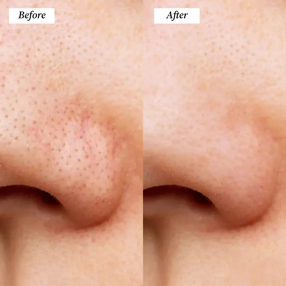 Cleansing Brush (Before and After) Visuals