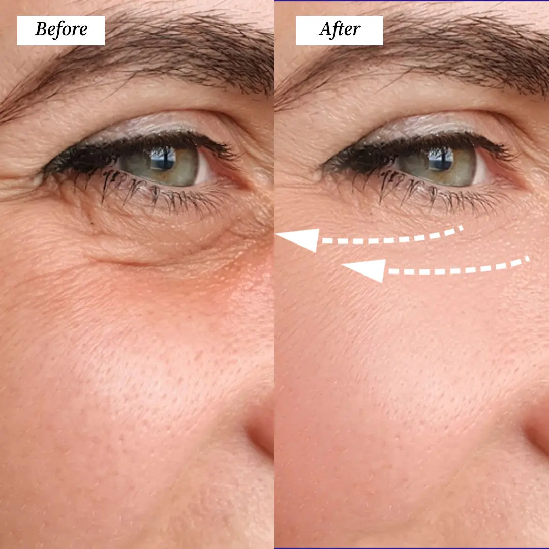 Electric Gua Sha (Before and After) Visuals