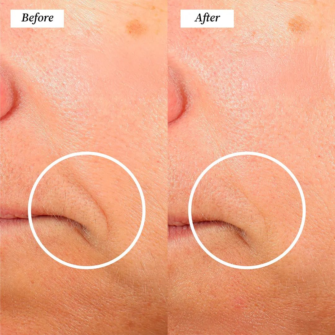 Electric Gua Sha (Before and After) Visuals