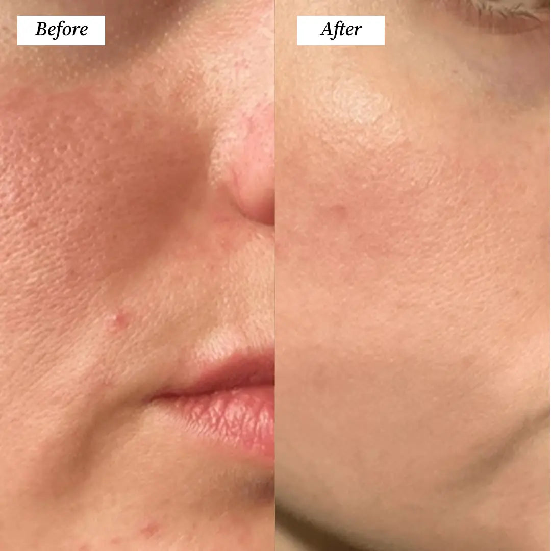 LED Face Mask (Before and After) Visuals