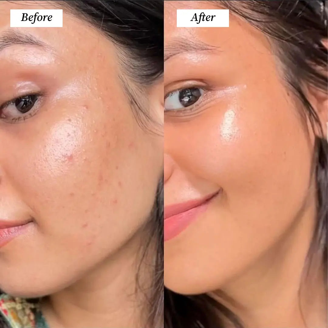 LED Face Mask (Before and After) Visuals