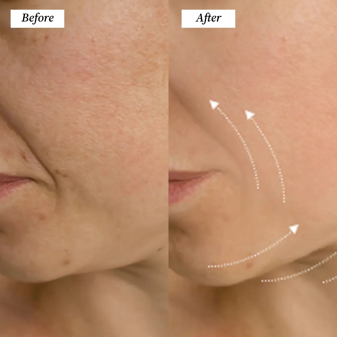 Electric Gua Sha (Before and After) Visuals