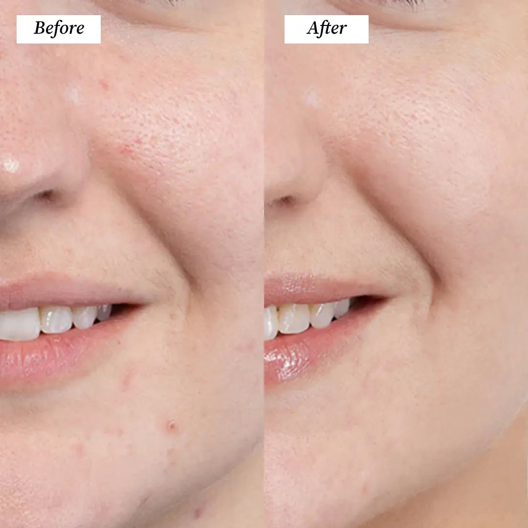 Cleansing Brush (Before and After) Visuals