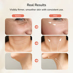 Before and after comparison of skin firmness and smoothness and smoother skin with consistent use.