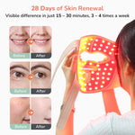 Manimo 4D LED face mask with before and after effects on skin, promoting 28 days of skin renewal.