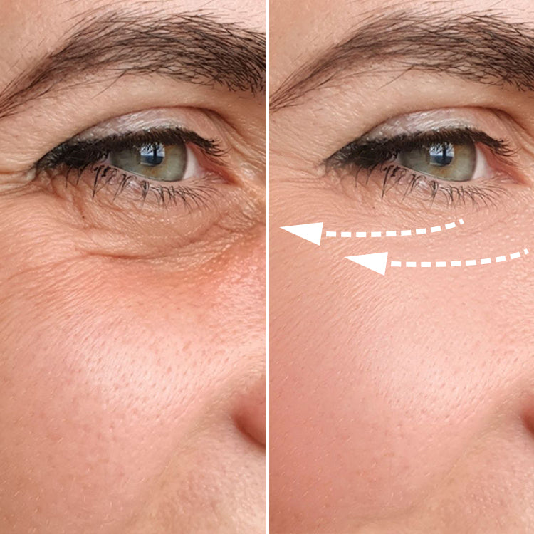 Electric Gua Sha (Before and After) Visuals