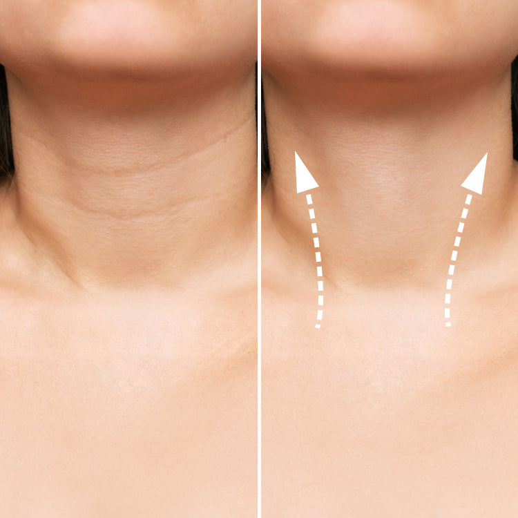 Electric Gua Sha (Before and After) Visuals