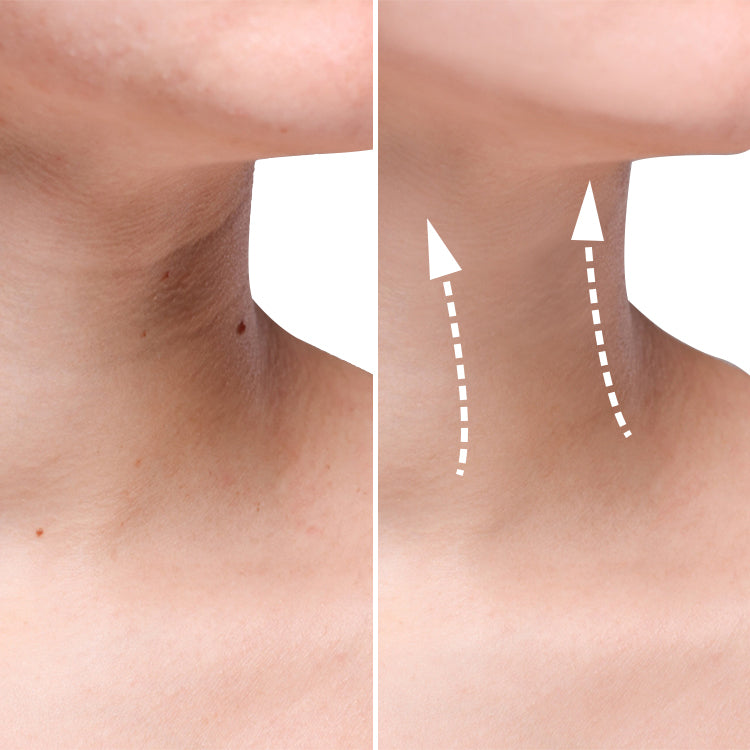 Electric Gua Sha (Before and After) Visuals