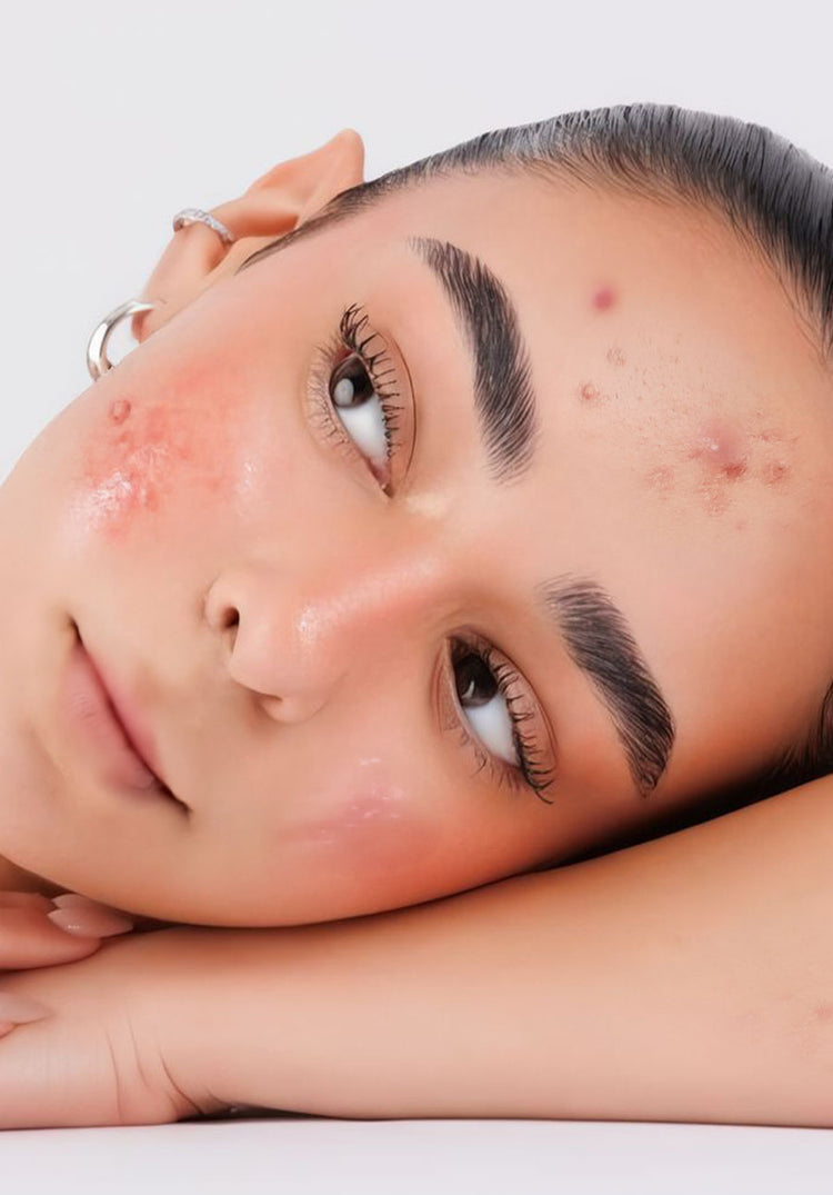 Your Skincare Upgrade, Visualized