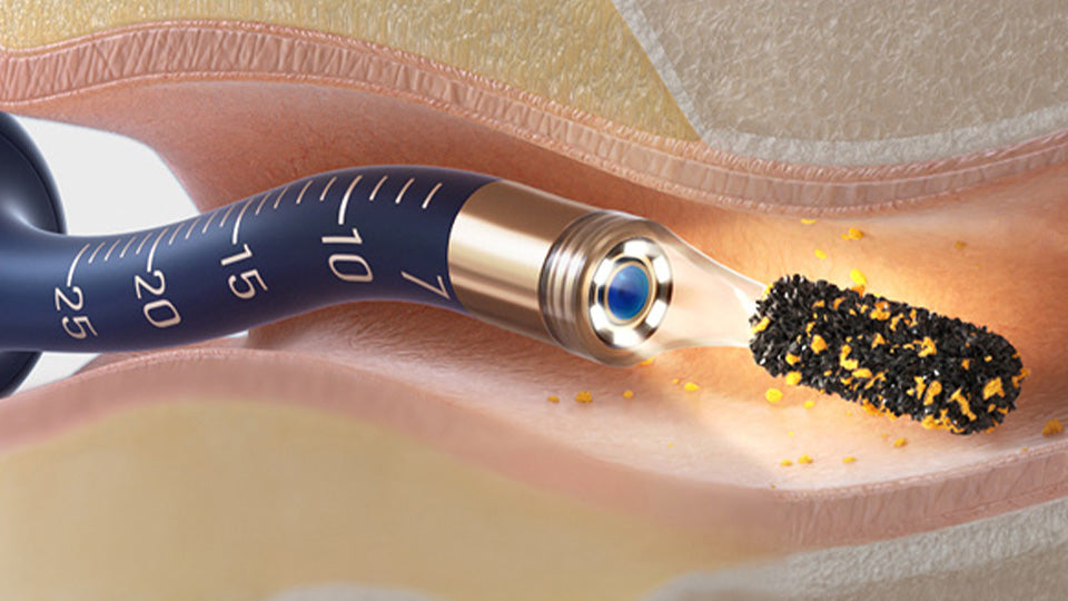 Smart & Easy Ear Cleaning - See, Clean & Protect Safely